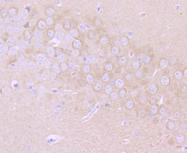 MMP17 Rabbit mAb