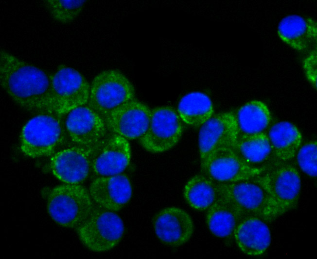 CRMP1 Rabbit mAb