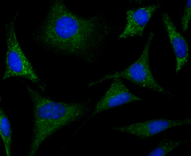 CRMP1 Rabbit mAb