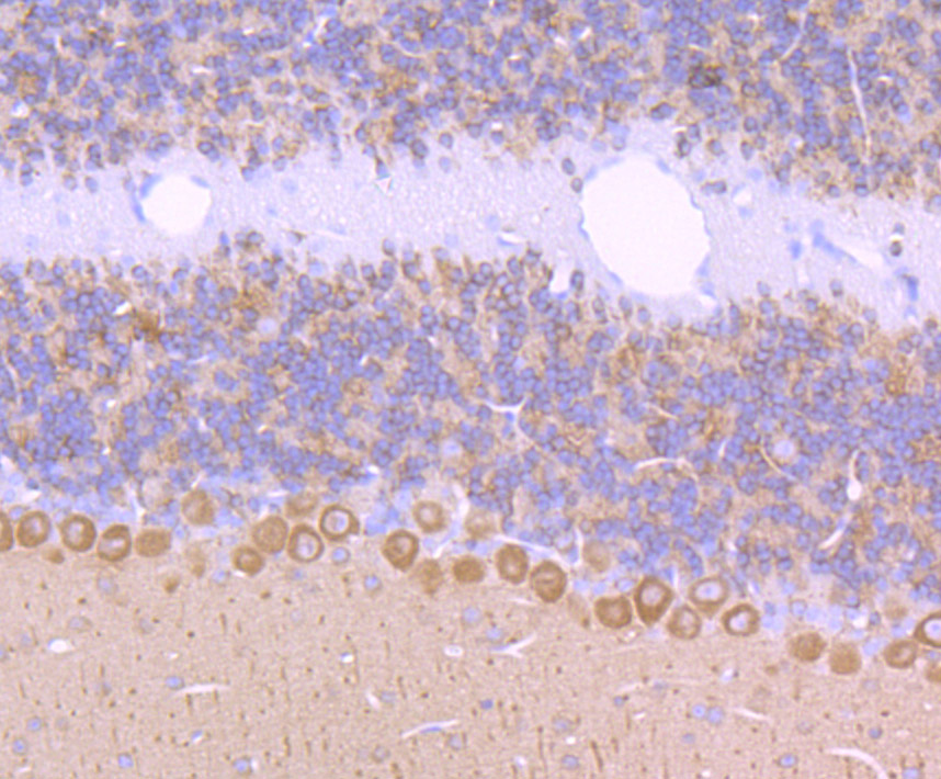 CRMP1 Rabbit mAb