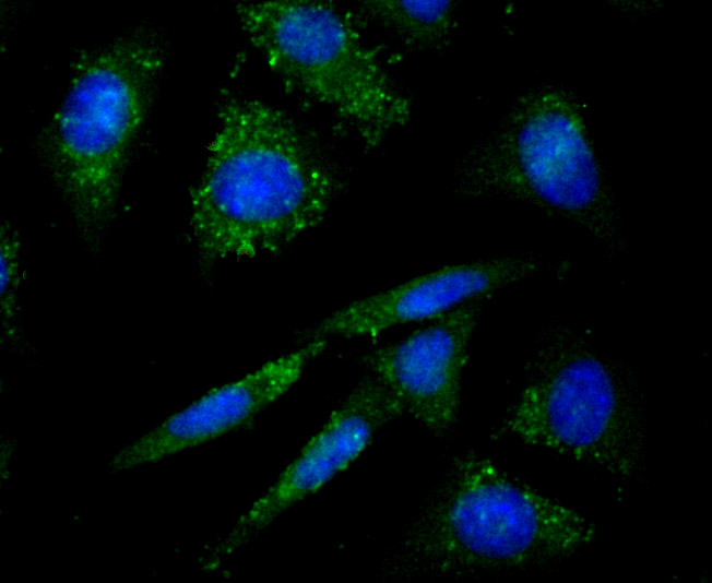 Protein Kinase D2 Rabbit mAb