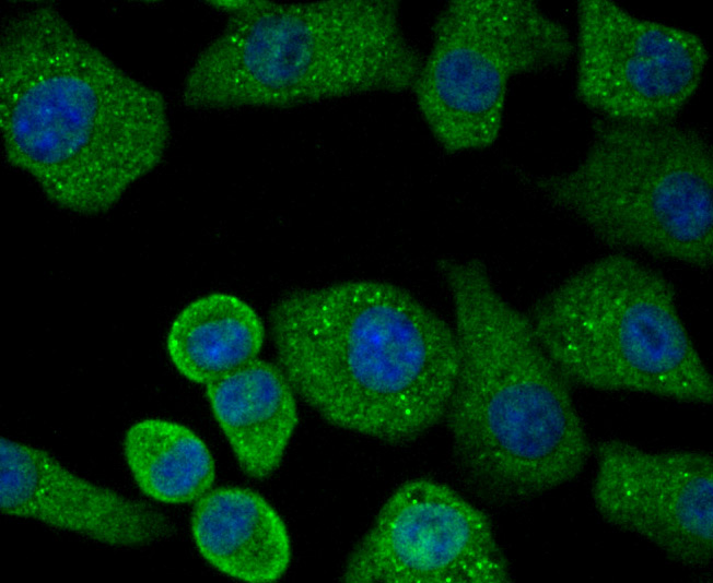 Protein Kinase D2 Rabbit mAb