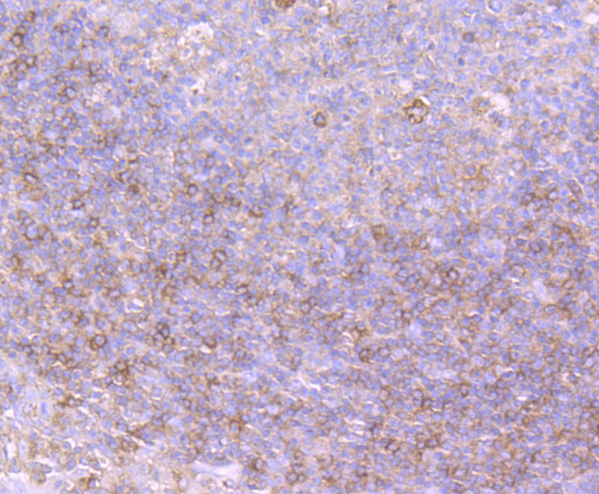 Protein Kinase D2 Rabbit mAb