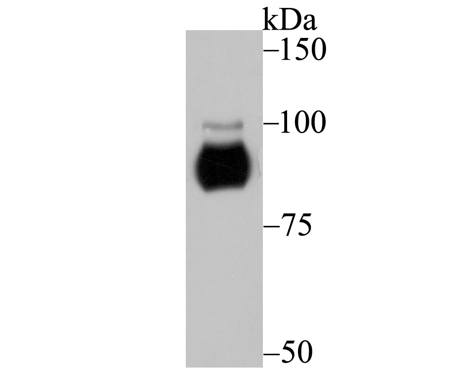 Protein Kinase D2 Rabbit mAb