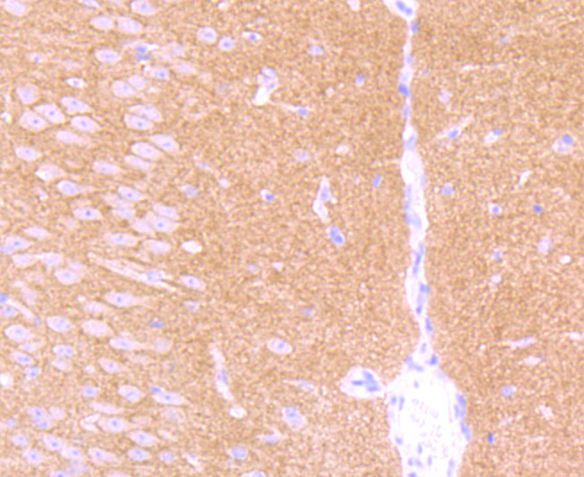 GABA B Receptor 2 Rabbit mAb