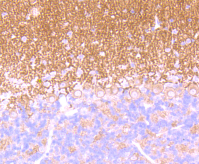 GABA B Receptor 2 Rabbit mAb