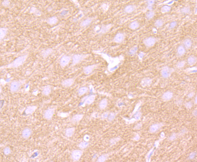 GABA B Receptor 2 Rabbit mAb