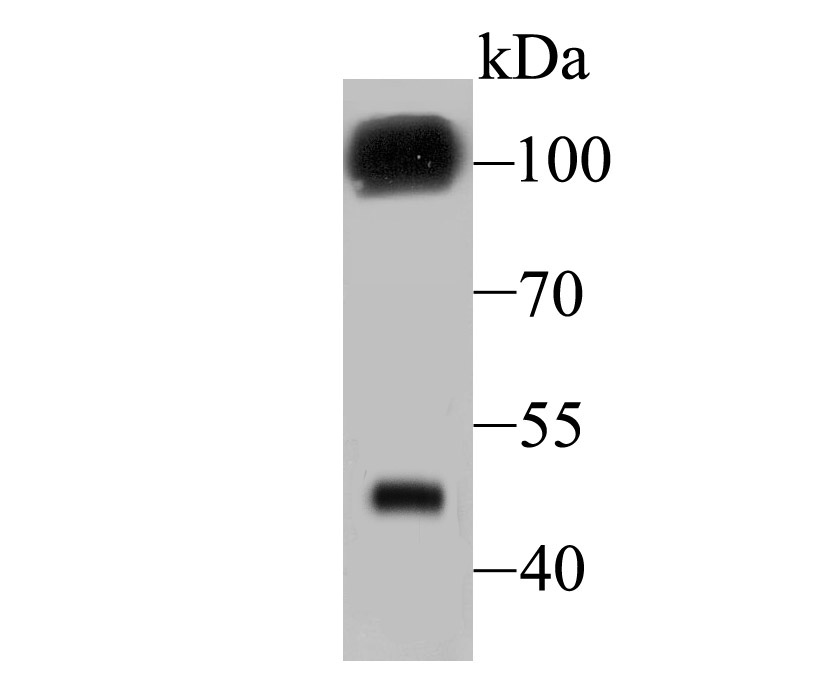 GABA B Receptor 2 Rabbit mAb