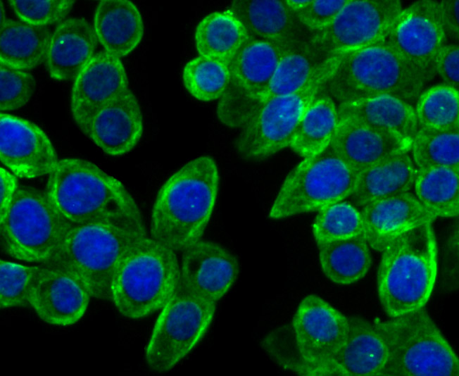 Cellular Apoptosis Susceptibility Rabbit mAb