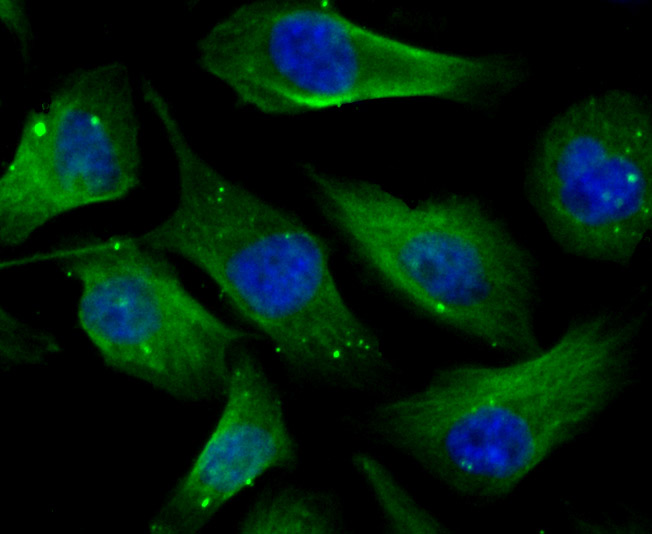 Cellular Apoptosis Susceptibility Rabbit mAb