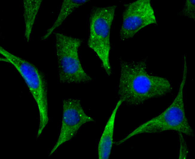 Cellular Apoptosis Susceptibility Rabbit mAb