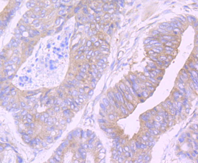 Cellular Apoptosis Susceptibility Rabbit mAb