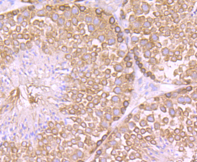 Cellular Apoptosis Susceptibility Rabbit mAb