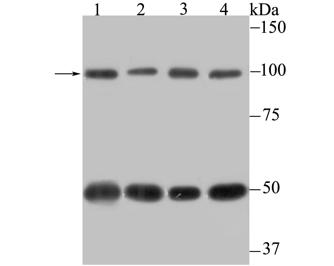 Cellular Apoptosis Susceptibility Rabbit mAb