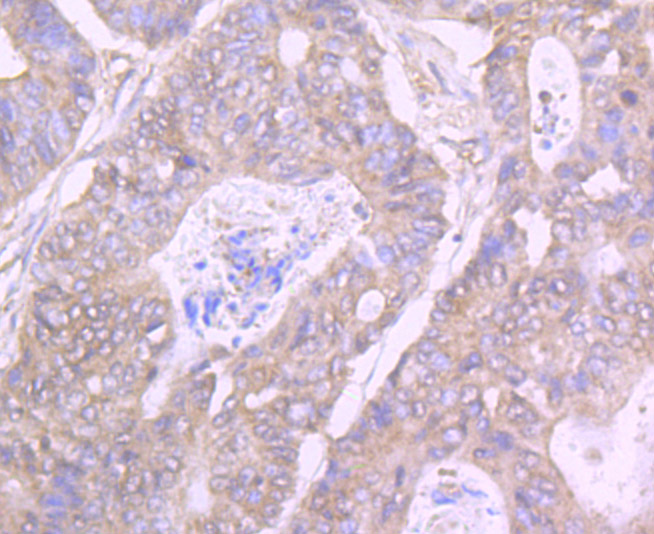 GIT1 Rabbit mAb