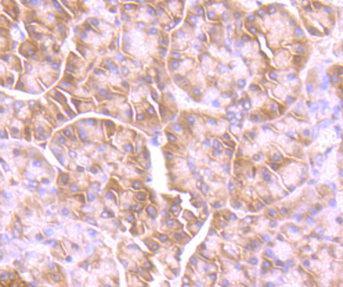 GIT1 Rabbit mAb