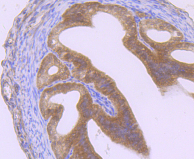 GIT1 Rabbit mAb