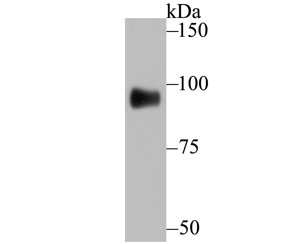 GIT1 Rabbit mAb