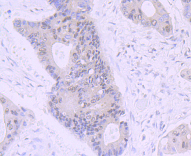 NR1D1 Rabbit mAb