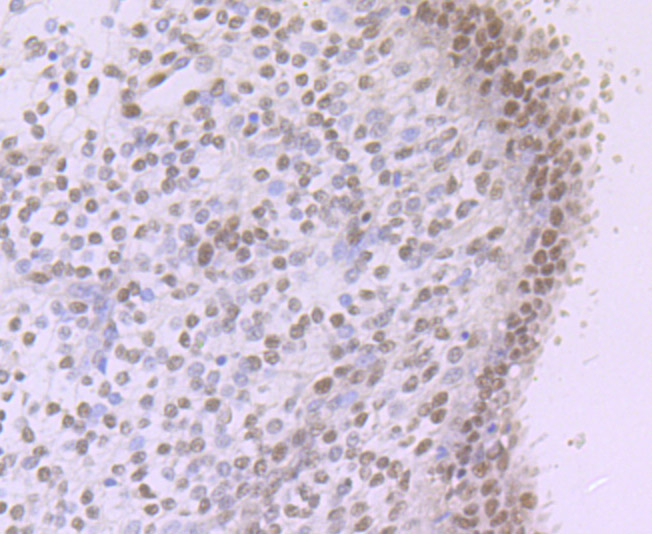 NR1D1 Rabbit mAb