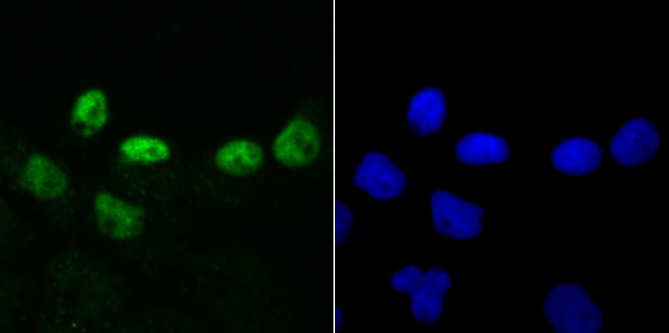 DKC1 Rabbit mAb