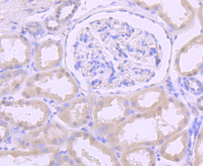 DKC1 Rabbit mAb