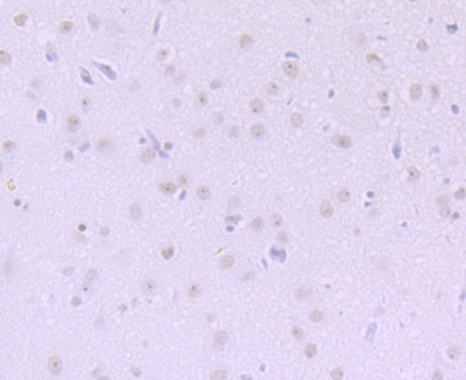 DKC1 Rabbit mAb