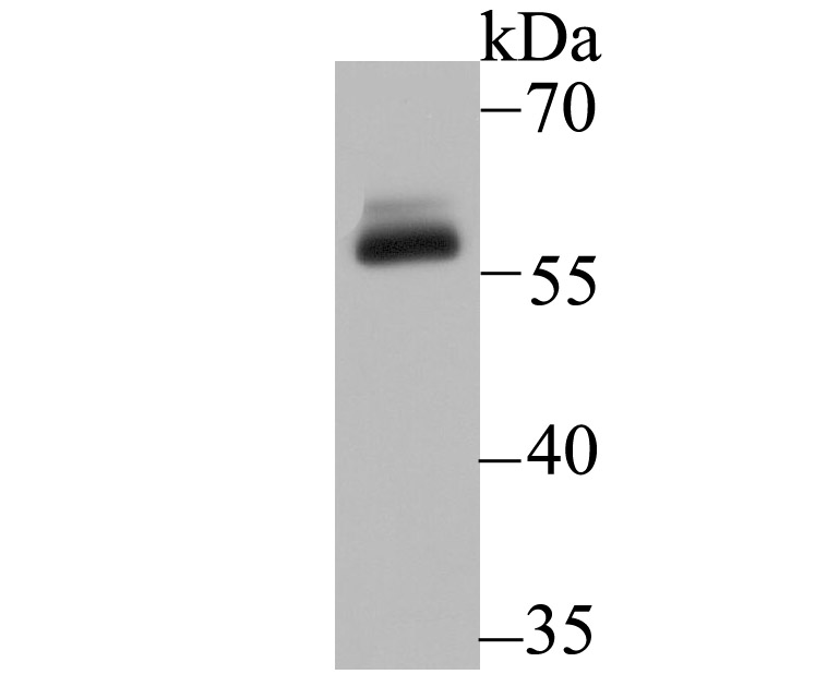 DKC1 Rabbit mAb