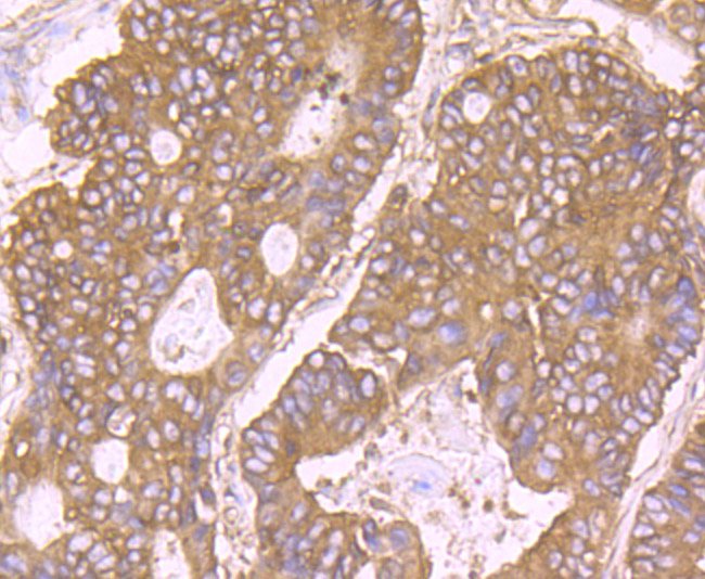 RPS19 Rabbit mAb