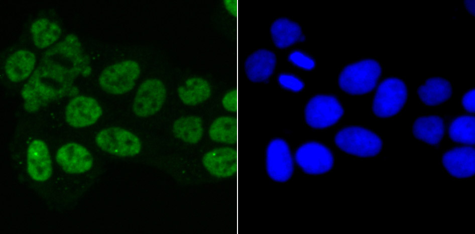 Matrin 3 Rabbit mAb