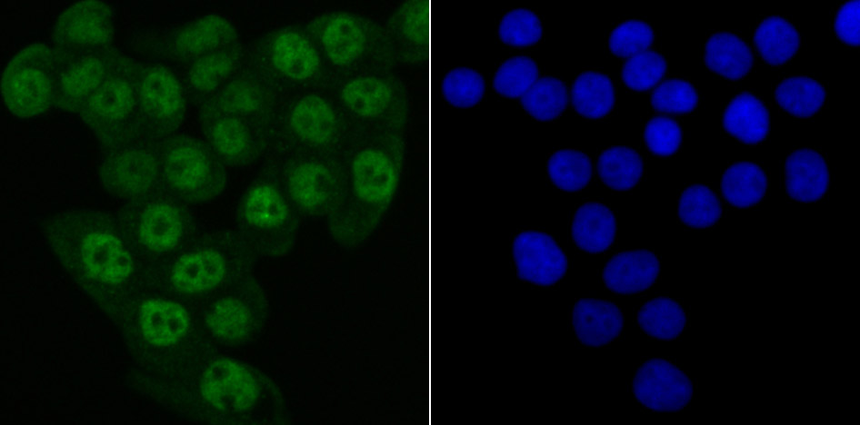 Matrin 3 Rabbit mAb