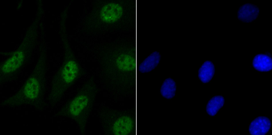 Matrin 3 Rabbit mAb