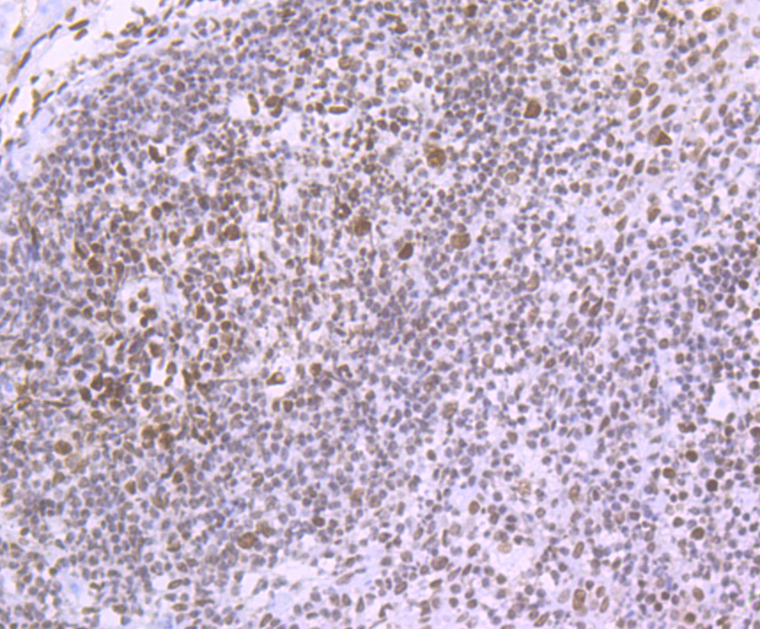 Matrin 3 Rabbit mAb