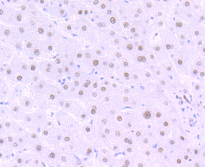 Matrin 3 Rabbit mAb