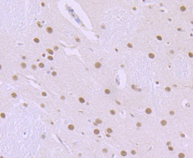 ILF2 Rabbit mAb