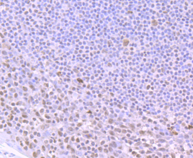 ILF2 Rabbit mAb