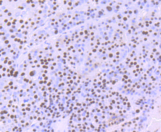 ILF2 Rabbit mAb