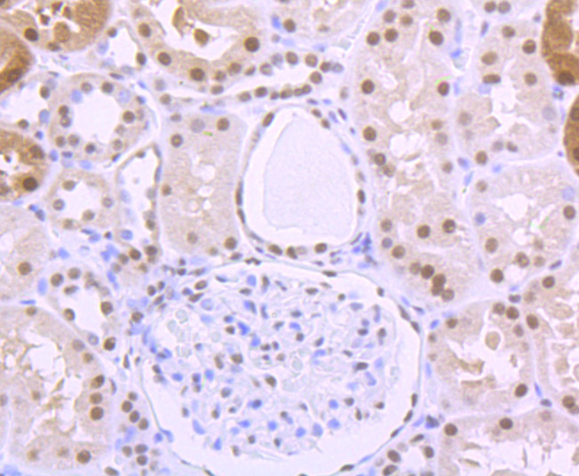 ILF2 Rabbit mAb