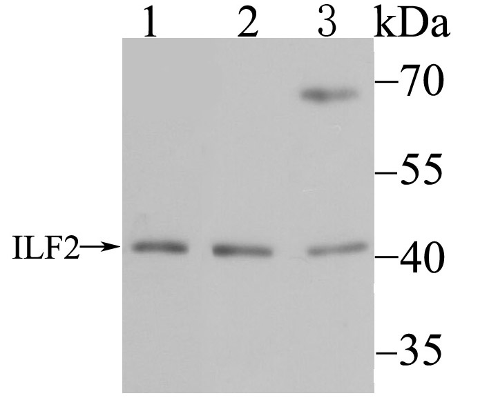 ILF2 Rabbit mAb