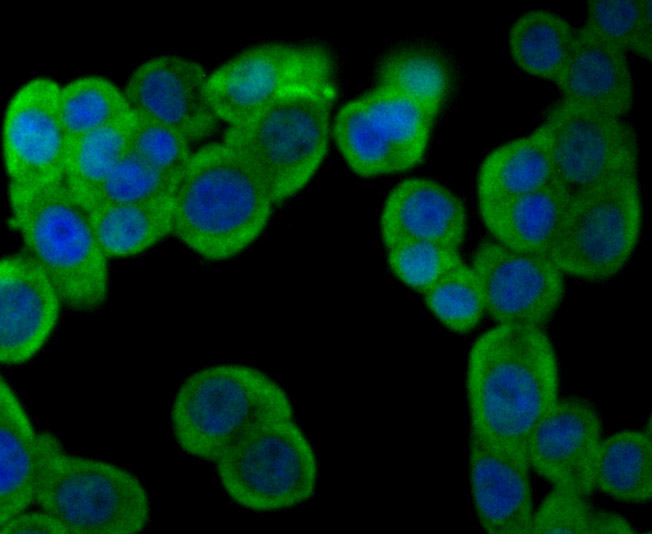 Fructose 6 Phosphate Kinase Rabbit mAb