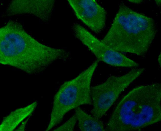 Fructose 6 Phosphate Kinase Rabbit mAb