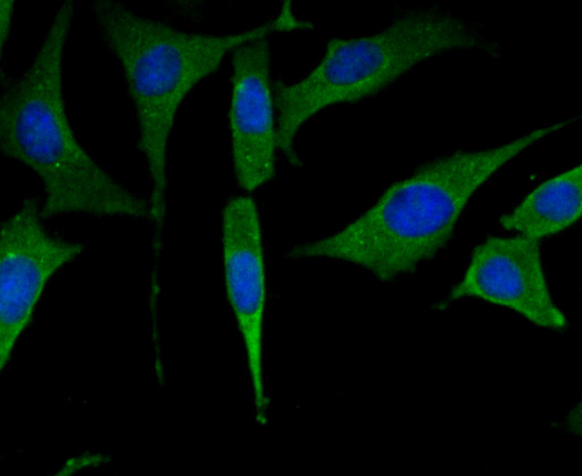 Fructose 6 Phosphate Kinase Rabbit mAb