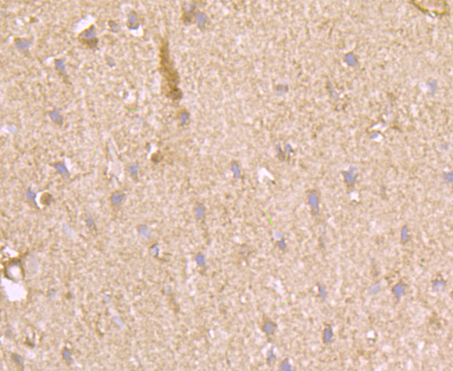 Fructose 6 Phosphate Kinase Rabbit mAb