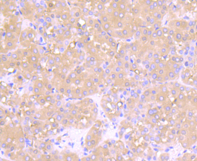 Fructose 6 Phosphate Kinase Rabbit mAb