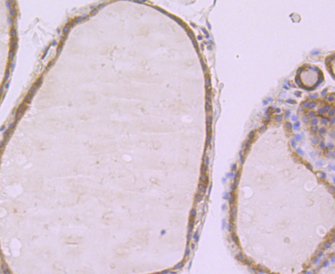 Fructose 6 Phosphate Kinase Rabbit mAb