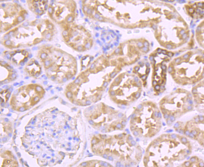 Fructose 6 Phosphate Kinase Rabbit mAb