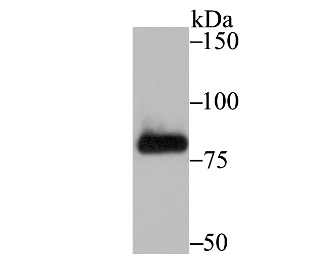 Fructose 6 Phosphate Kinase Rabbit mAb