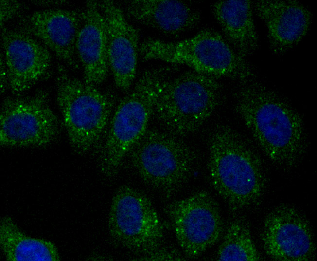 PSME1 Rabbit mAb