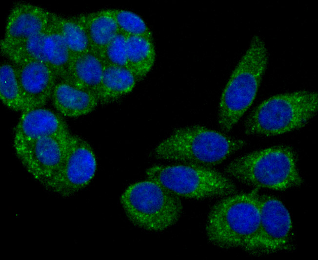 PSME1 Rabbit mAb