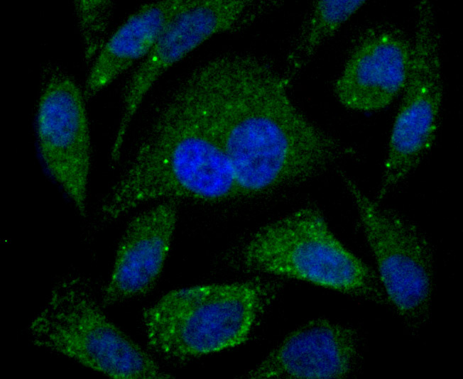 PSME1 Rabbit mAb